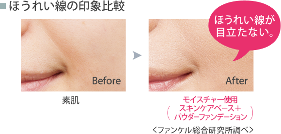 ほうれい線の印象比較