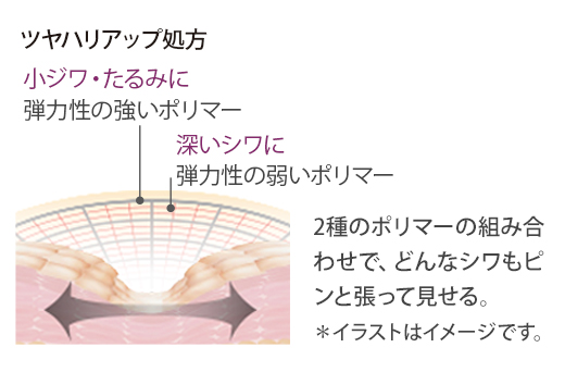 ツヤハリアップ処方