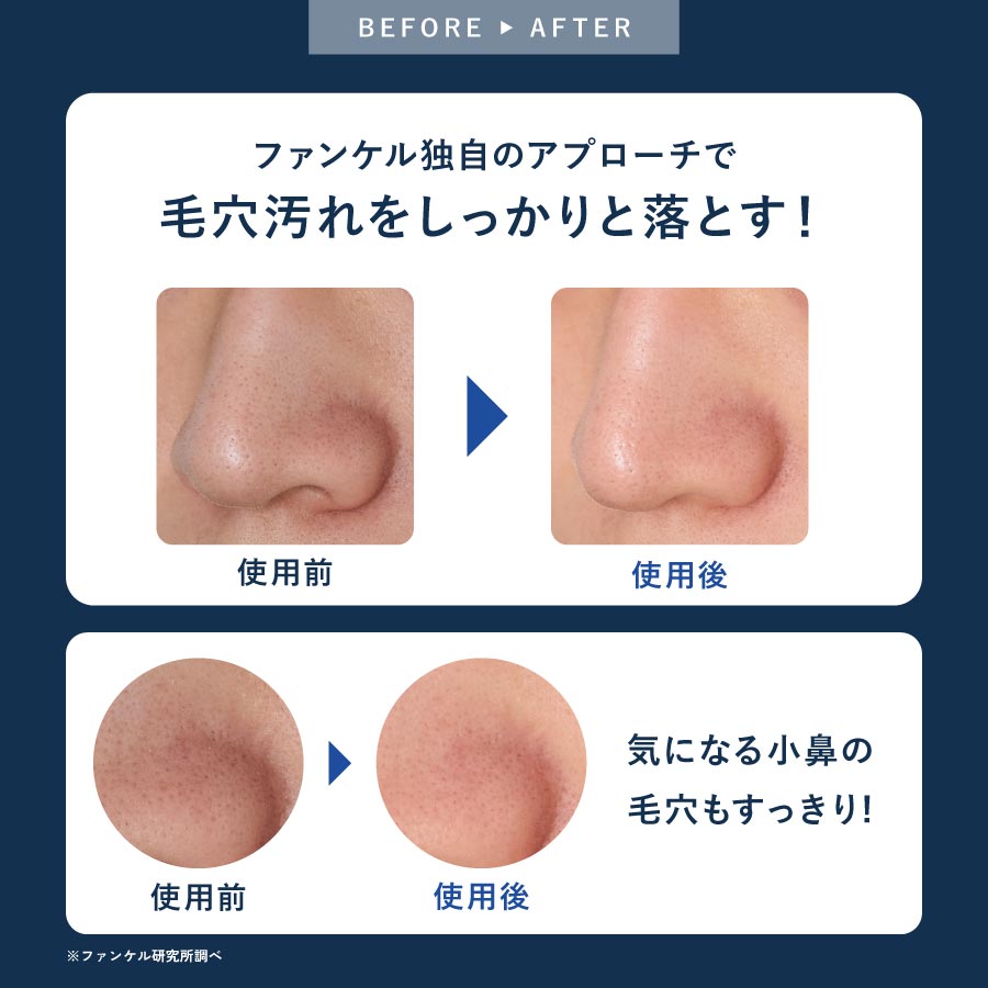 マイルドクレンジング オイル＜ブラック＆スムース＞