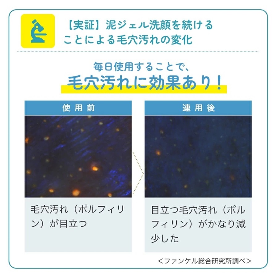 泥ジェル洗顔