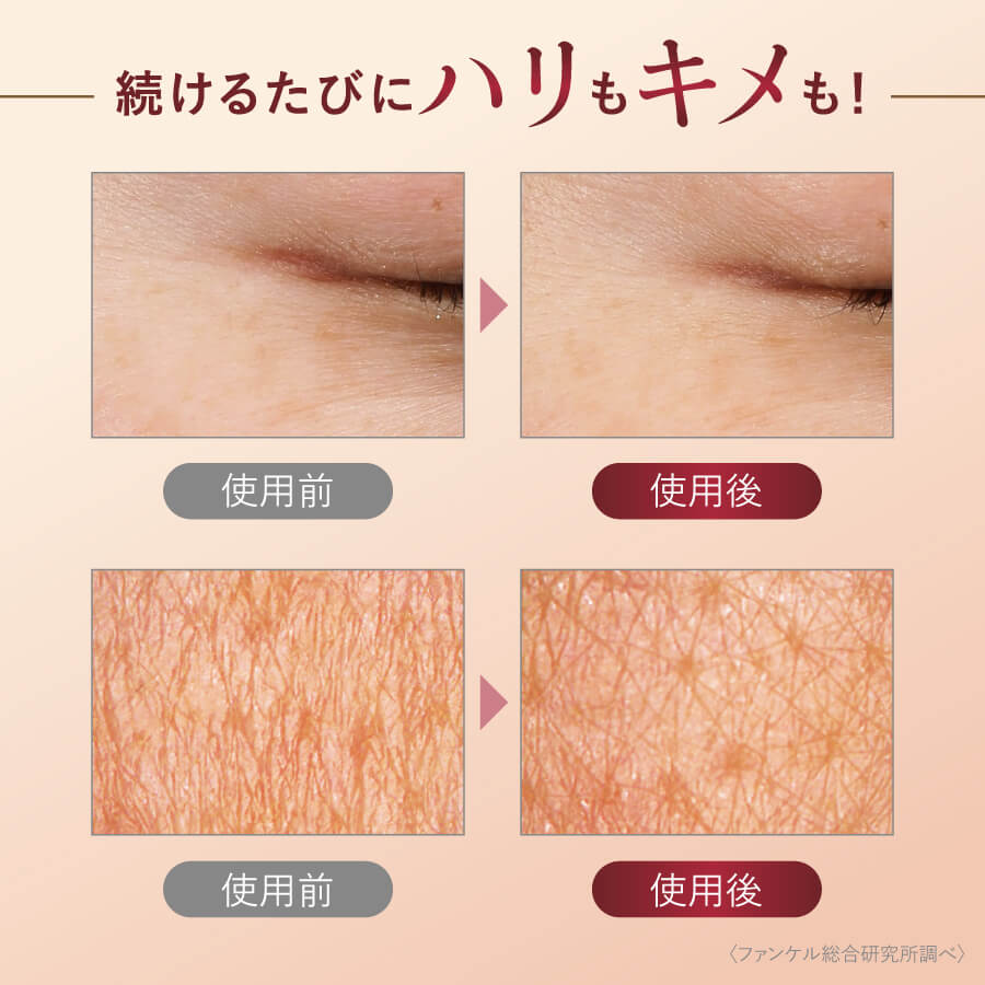 シールドチャージ クリーム