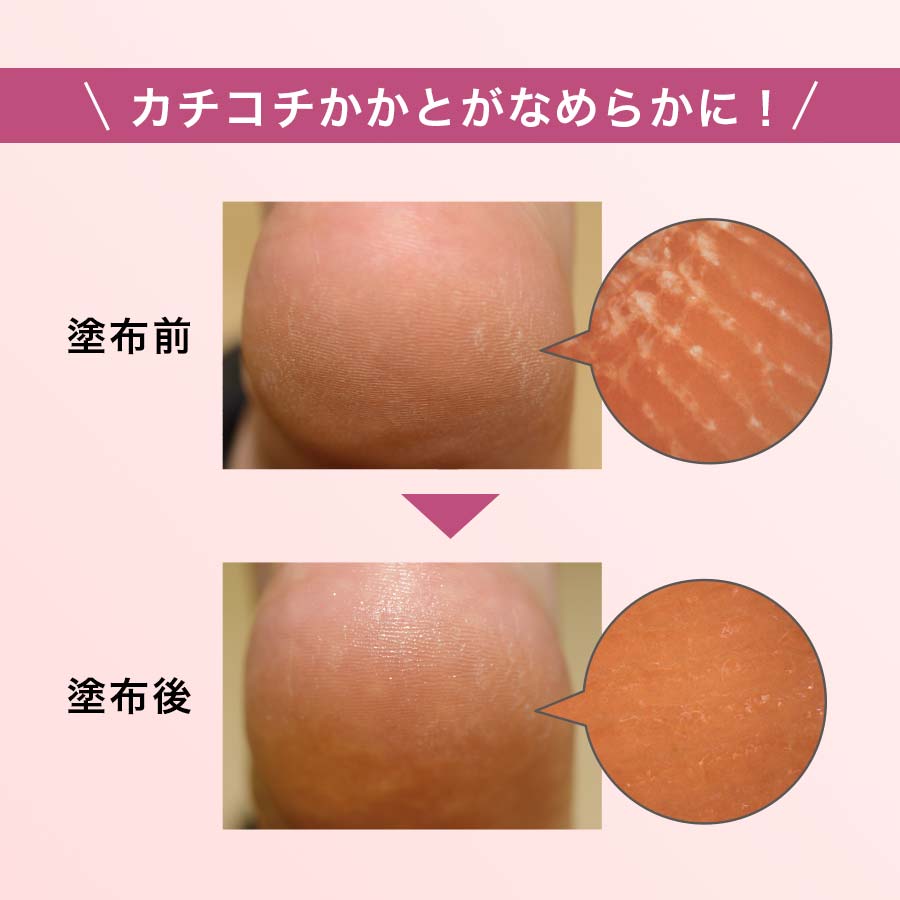 ビューティブーケ うるおいかかとクリーム