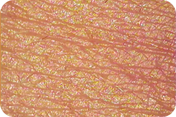 乾燥小ジワの拡大画像