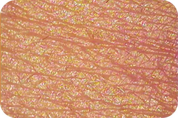 乾燥小ジワの拡大画像