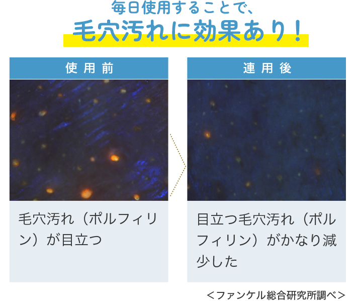 毎日使用することで、毛穴汚れに効果あり！