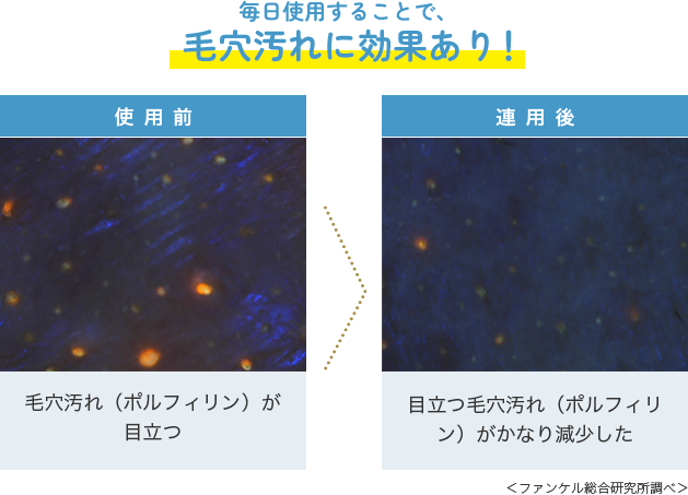 毎日使用することで、毛穴汚れに効果あり！