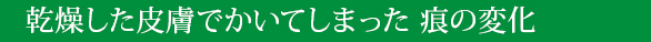 乾燥した皮膚でかいてしまった 痕の変化