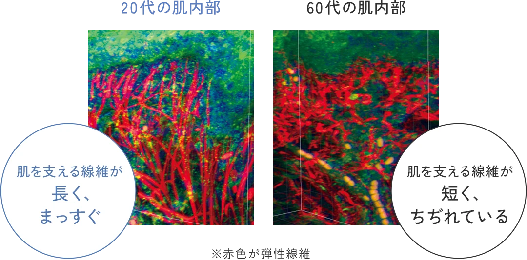 20代の肌内部 肌を支える線維が長く、まっすぐ 60代の肌内部 肌を支える線維が短く、ちぢれている ※赤色が弾性線維