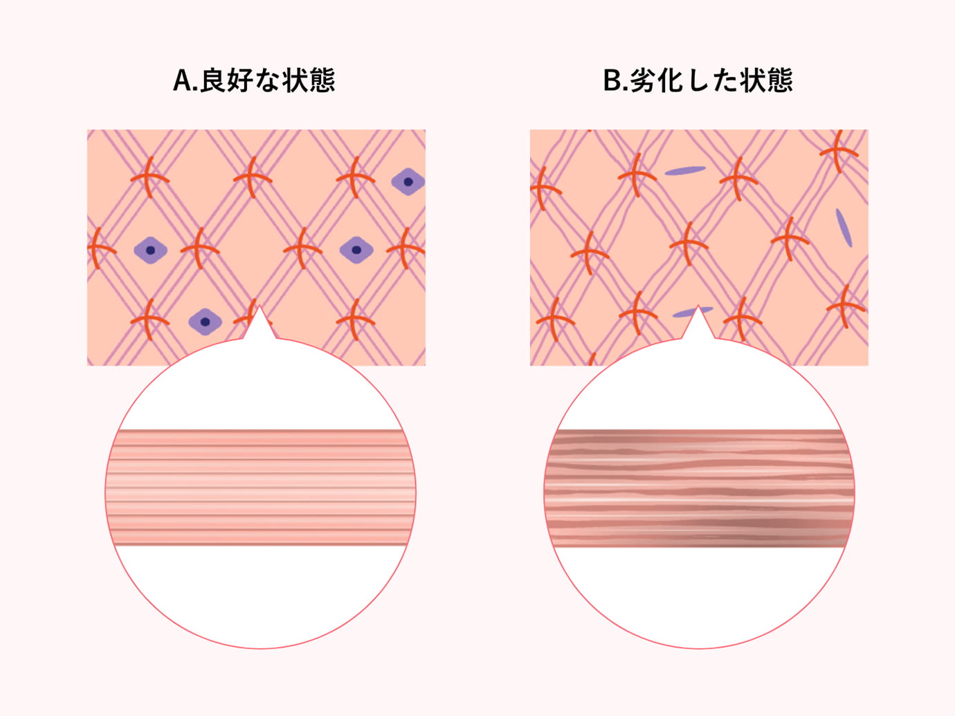 良好なコラーゲン 劣化したコラーゲン