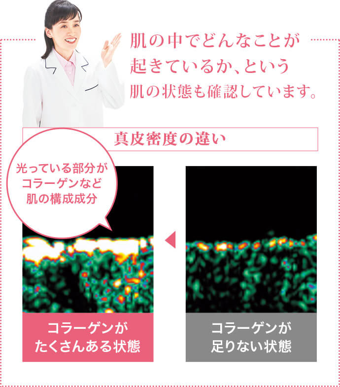 肌の中でどんなことが起きているか、という肌の状態も確認しています。