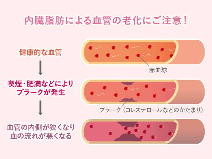 内臓脂肪による血管の老化にご注意! 健康的な血管→喫煙・肥満などによりプラークが発生→血管の内側が狭くなり血の流れが悪くなる