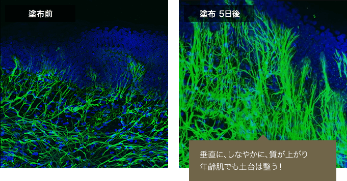 塗布前 塗布5日後 垂直に、しなやかに、質が上がり年齢肌でも土台は整う！