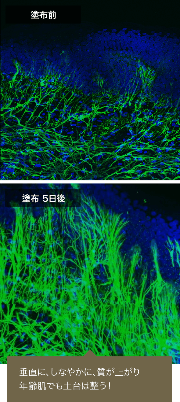 塗布前 塗布5日後 垂直に、しなやかに、質が上がり年齢肌でも土台は整う！