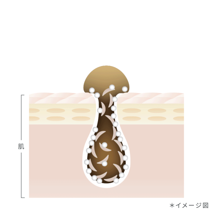 角栓クラッシュテクノロジー徹底解説