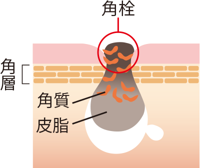 毛穴汚れの正体は…油!?「皮脂」と「角質」が固まった「角栓」だった!
