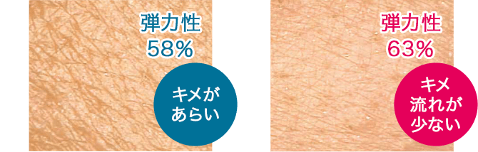 弾力性 58% [キメがあらい] 弾力性 63% [キメ流れが少ない]