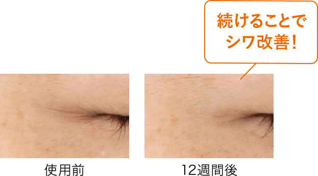 続けることでシワ改善！
