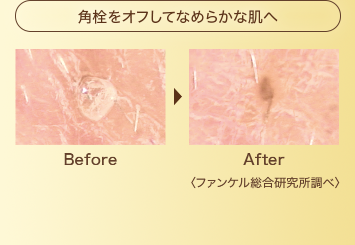 角栓をオフしてなめらかな肌へ Before After〈ファンケル総合研究所調べ〉