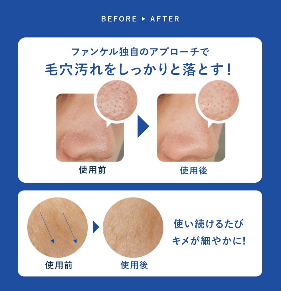 ファンケル独自のアプローチで毛穴汚れをしっかりと落とす!