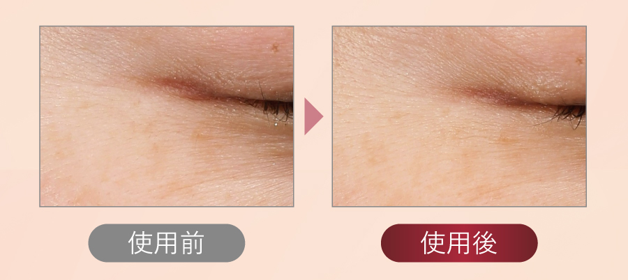 使用前／使用後