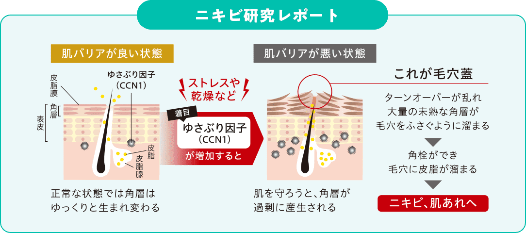 ニキビ研究レポート 肌バリアが良い状態と肌バリアが悪い状態の比較