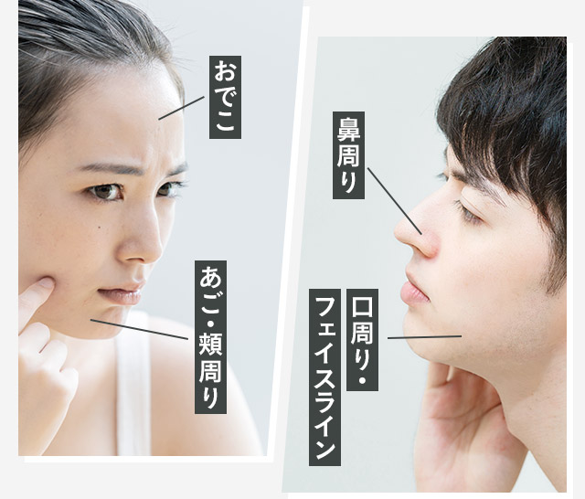 おでこ/あご・頬周り/鼻周り/口周り・フェイスライン