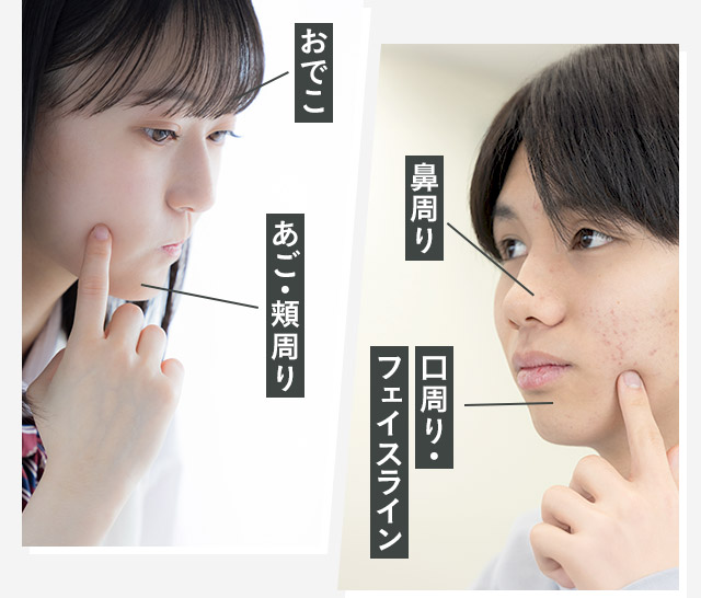 おでこ/あご・頬周り/鼻周り/口周り・フェイスライン