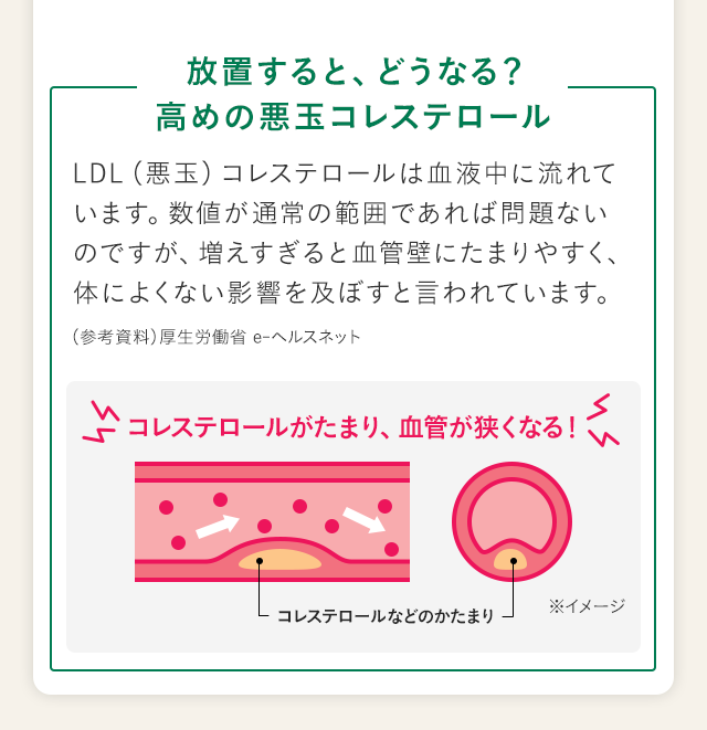 放置すると、どうなる？高めの悪玉コレステロール LDL（悪玉）コレステロールは血液中に流れています。数値が通常の範囲であれば問題ないのですが、増えすぎると血管壁にたまりやすく、体によくない影響を及ぼすと言われています。