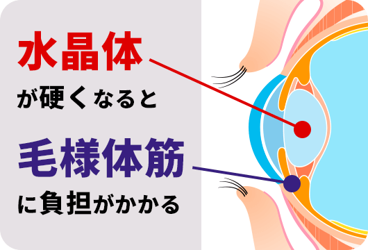 水晶体が硬くなると毛様体筋に負担がかかる