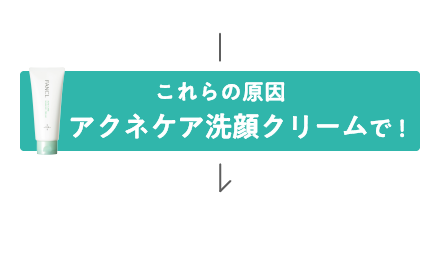 これらの原因アクネケア洗顔クリームで！