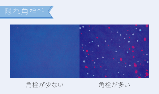 隠れ角栓社 角栓が少ない 角栓が多い*1ポルフィリン *2肌の奥でつくられるシミのこと