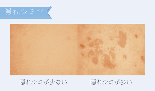 隠れシミ*2 隠れシミが少ない 隠れシミが多い