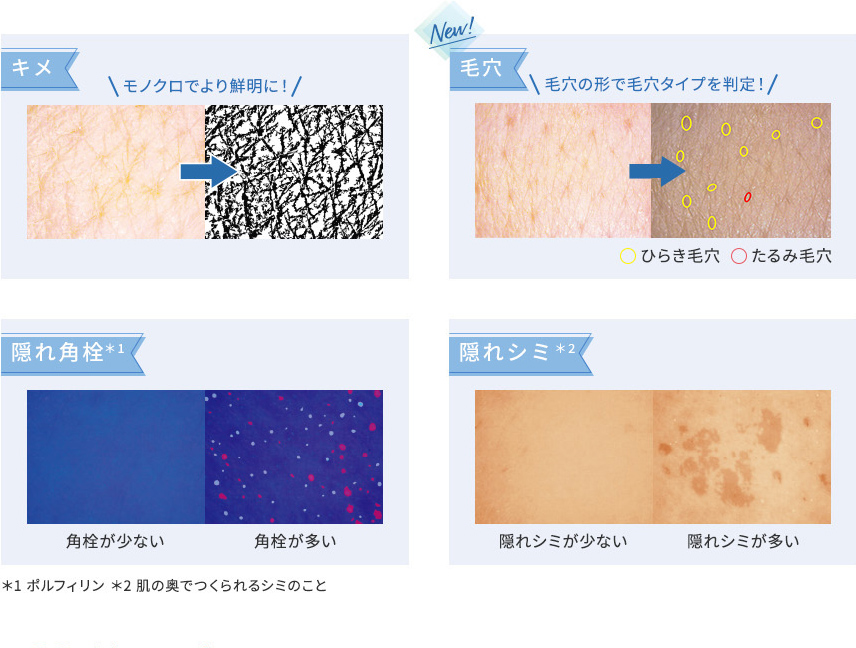 キメモノクロでより鮮明に!毛穴 毛穴の形で毛穴タイプを判定!ひらき毛穴 ●たるみ毛穴隠れ角栓社 角栓が少ない 角栓が多い*1ポルフィリン *2肌の奥でつくられるシミのこと隠れシミ*2 隠れシミが少ない 隠れシミが多い
