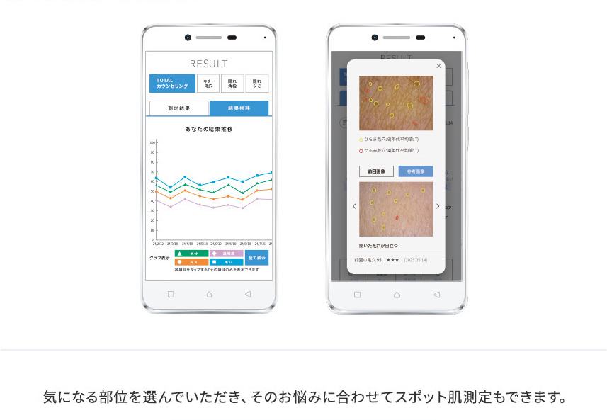 気になる部位を選んでいただき、そのお悩みに合わせてスポット肌測定もできます。