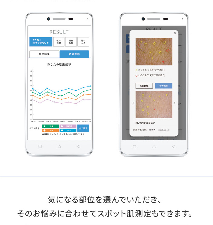 気になる部位を選んでいただき、そのお悩みに合わせてスポット肌測定もできます。