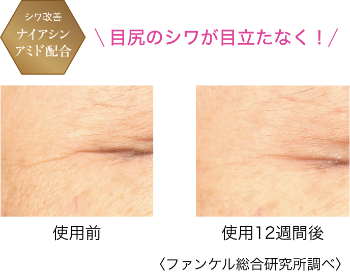 目尻のシワが目立たなく!/使用前/使用12週間後
