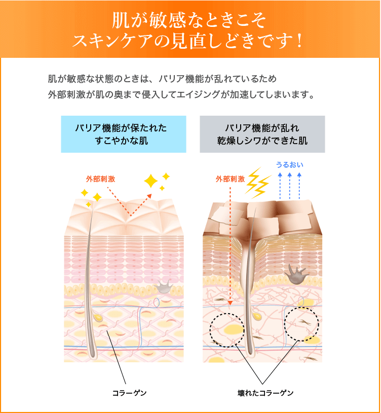 肌が敏感なときこそスキンケアの見直しどきです!